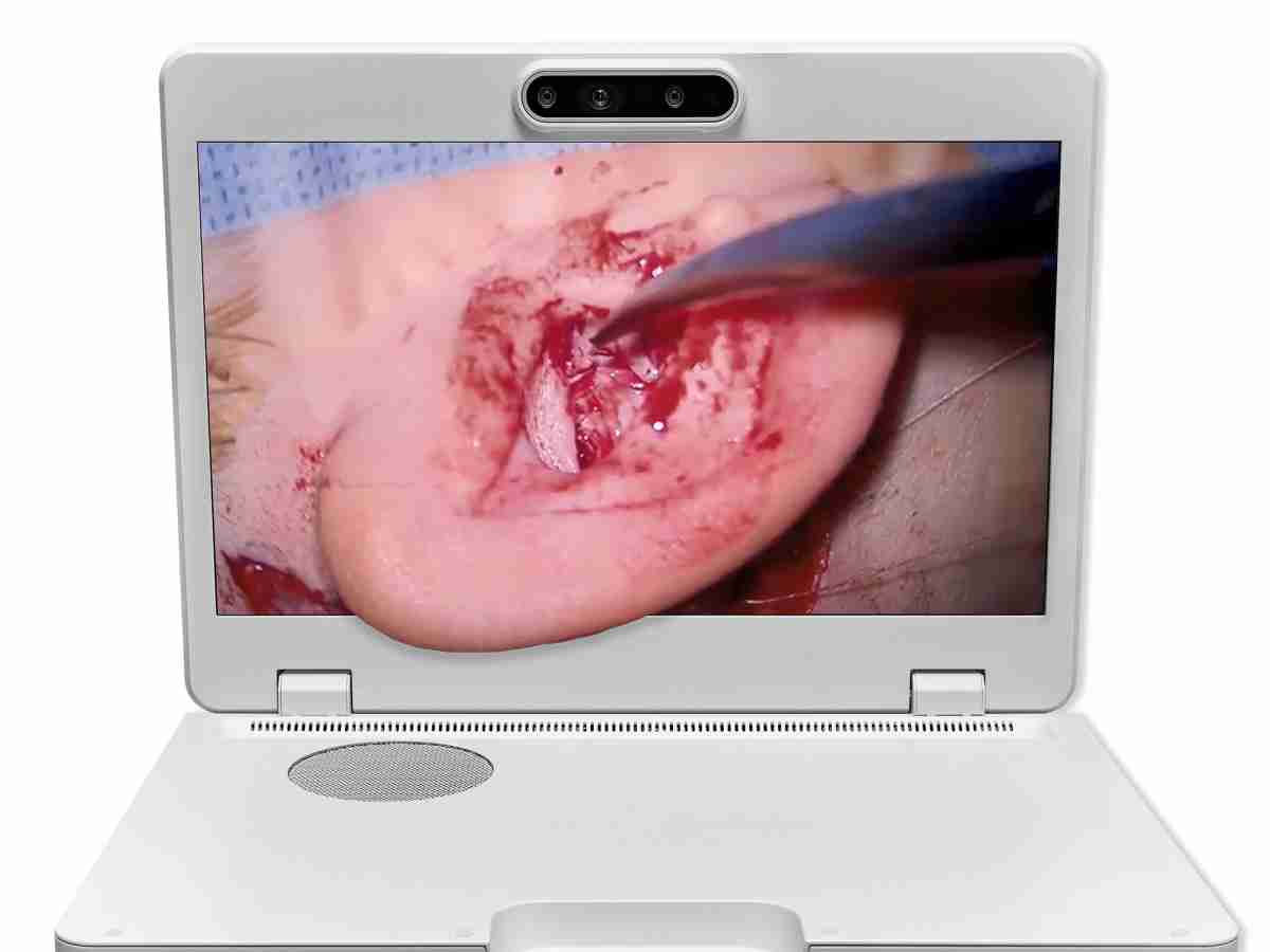 达擎之＂Heads-up 3D显微手术显示系统＂，，，，整合4K裸眼3D显示及眼球追踪系统，，，具备快速追踪人眼移动位置功能，，减轻医师长时间维持固定姿势的负担，，，让医师能有更宽广清晰的3D立体视野及更舒适的姿势来执行手术。。